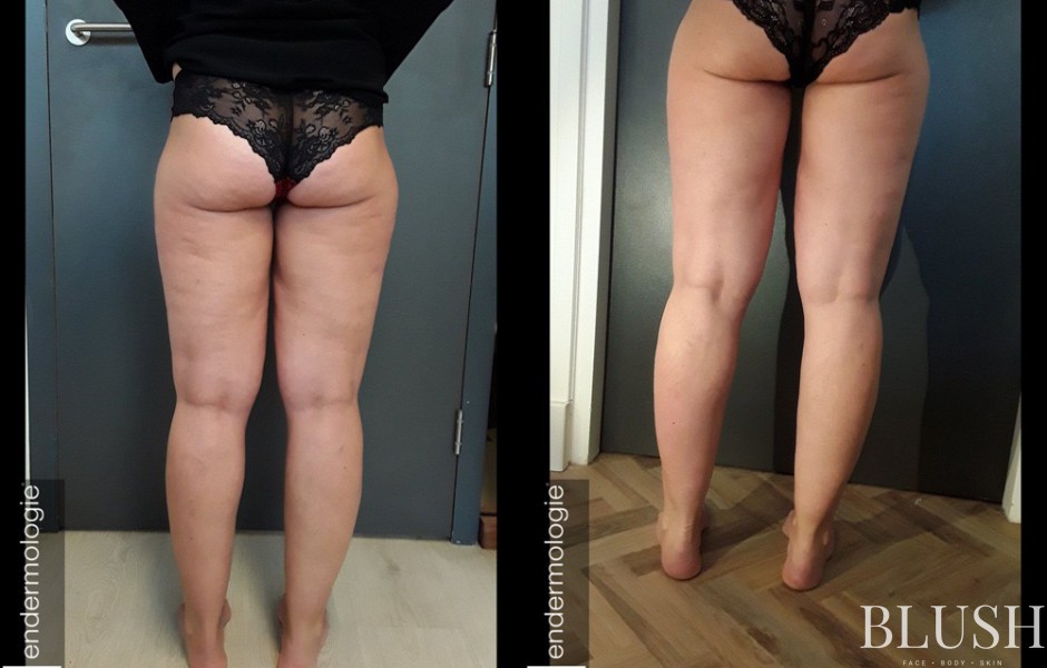 foto sfeerimpressie blush clinic 3