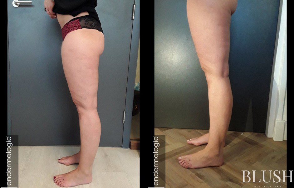 foto sfeerimpressie blush clinic 2
