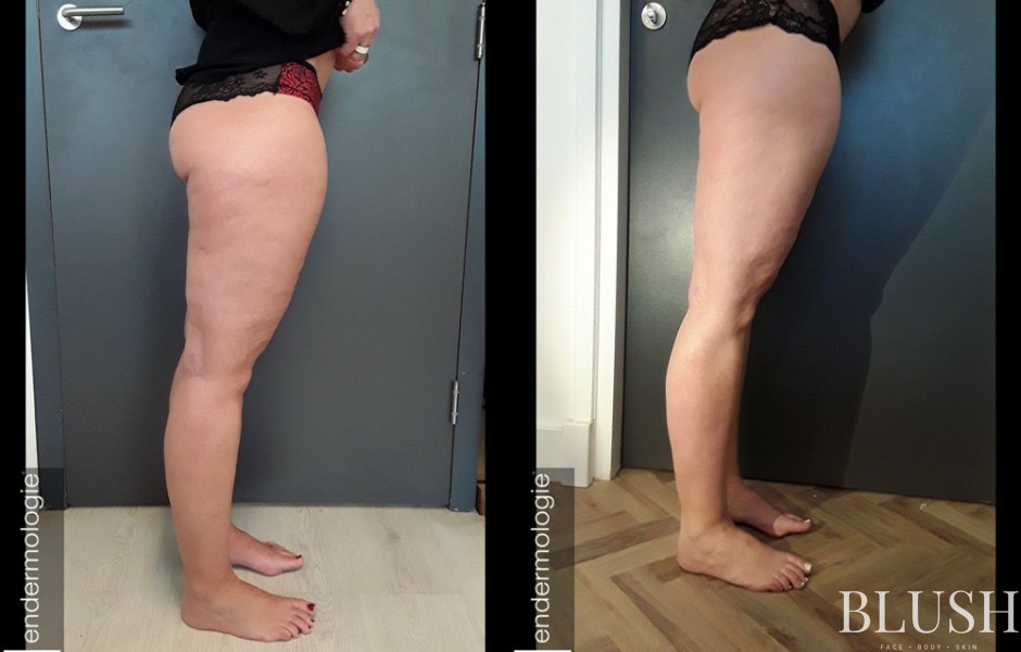 foto sfeerimpressie blush clinic 1