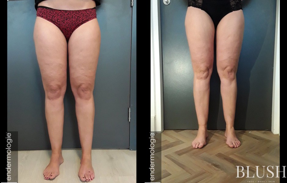 foto sfeerimpressie blush clinic 0