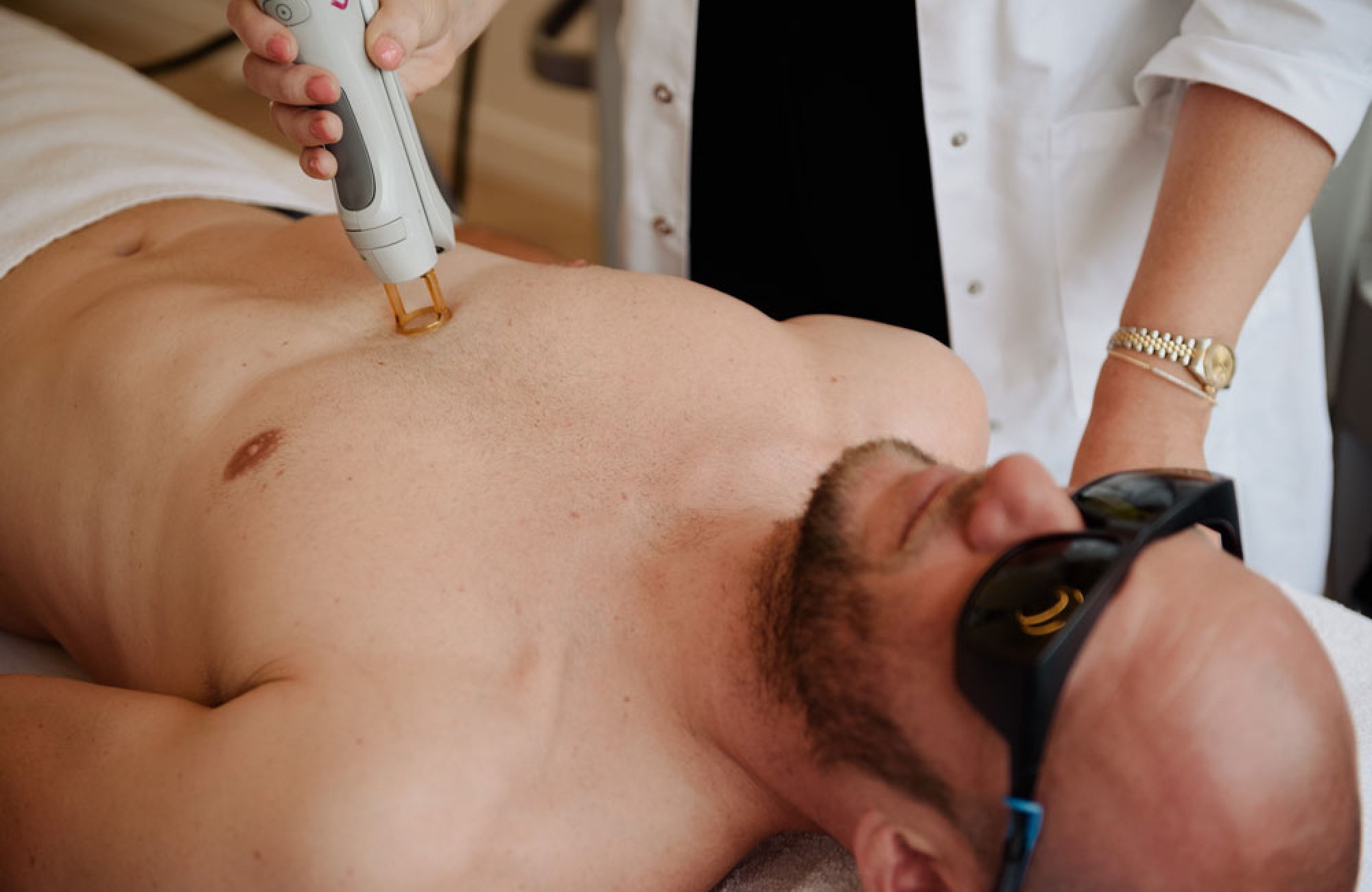foto tijdens een laser ontharingsbehandeling voor een man op de borst