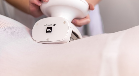LPG Endermologie vet, huid en cellulite