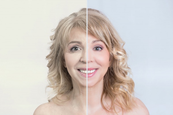 foto met vrouw voor en na anti-aging behandeling