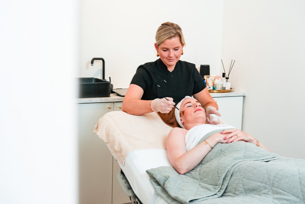 foto edwina die een chemische peeling uitvoert