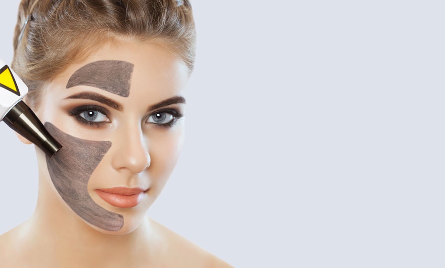 Begeleidende afbeelding carbon laser peel
